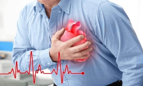 Bệnh tim mạch những điều bạn chưa biết?