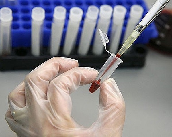 Địa chỉ xét nghiệm phơi nhiễm HIV nhanh chóng – chính xác – bảo mật tại Hà Nội