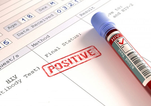 Kết quả HIV dương tính nghĩa là gì?