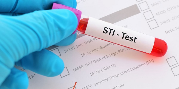 Làm thế nào để ngăn ngừa nhiễm trùng lây qua đường tình dục (STIs)?