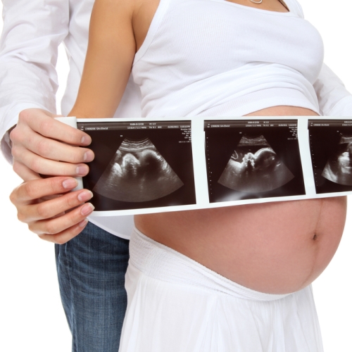 Những điều mẹ bầu cần lưu ý khi siêu âm thai