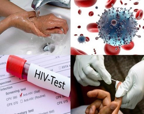 Phơi nhiễm HIV là gì? Địa chỉ điều trị phơi nhiễm HIV  uy tín, bảo mật tại Hà Nội ?
