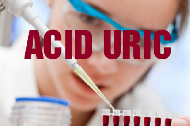 Xét nghiệm Acid Uric? Khi nào cần làm xét nghiệm Acid Uric?