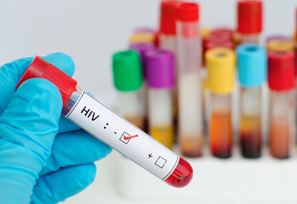Xét nghiệm HIV là gì? Các phương pháp xét nghiệm HIV
