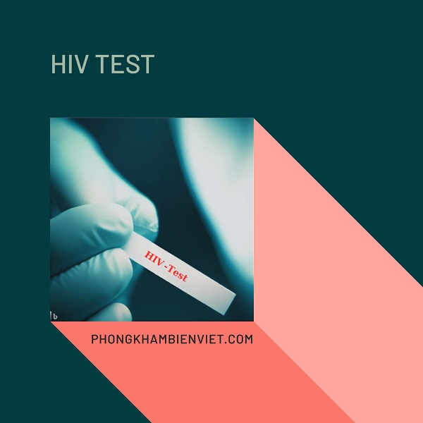 Xét nghiệm HIV sau bao lâu có kết quả chính xác