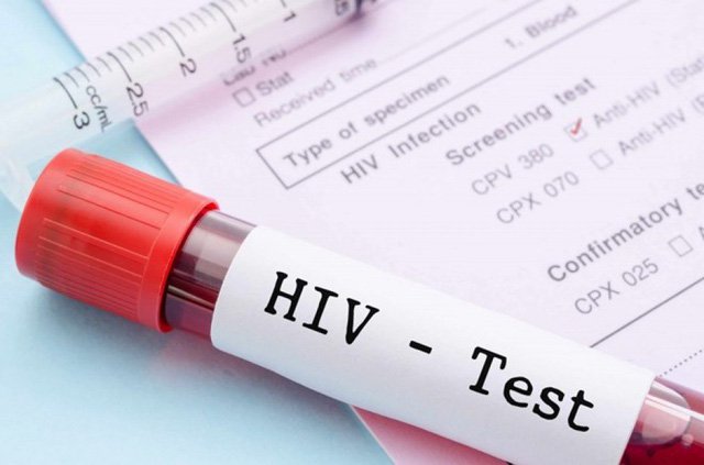 Xét nghiệm HIV và Giang Mai những điều bạn cần biết?